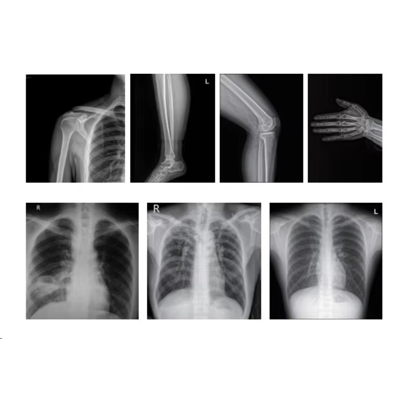Medical Imaging X-ray Machine  - Photography X Ray review and price